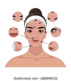 Portrait of a woman with age-related changes on the face and wrinkles. Illustration for a beauty salon, cosmetic procedures, injections, plastic surgery. Flat vector illustration