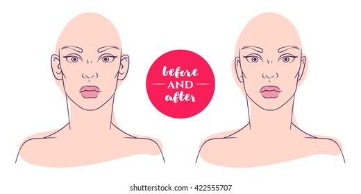 Protruding Ears Images Stock Photos Vectors Shutterstock