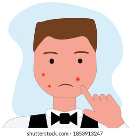 Portrait of young man with acne problem squishing pimples on light background