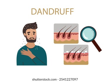 Retrato de jovem com problema de caspa. Medicina da saúde, tricologia, conceito dermatológico. Ilustração de desenho plano à mão desenhada em vetor.