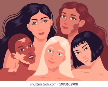 Portrait Of Young Women With Different Skin Types.