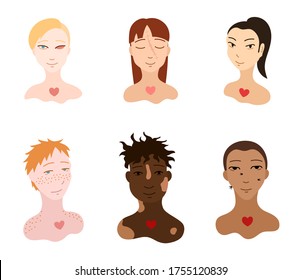 Portraits of body positive people set. Flat style isolated illustration on white background. Love yourself motivation. Faces with injuries and skin features.