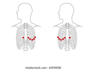 906 Chest lead Images, Stock Photos & Vectors | Shutterstock