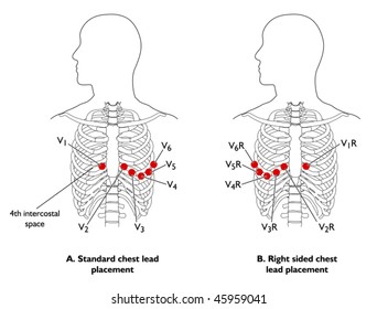 Position Of ECG Chest Leads - Labeled