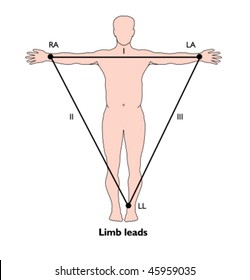 Position Of ECG Limb Leads - Labeled