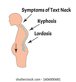 The position of the spine with lordosis, kyphosis. Text Neck Syndrome. Spinal curvature, kyphosis, lordosis, scoliosis, arthrosis. Poor posture and slouching. Infographics. Vector illustration.