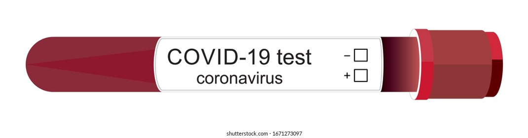 Positive COVID-19 test and laboratory sample of blood testing for diagnosis new Corona virus infection