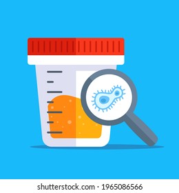 Positive Result In Urine Analysis. Flat Vector Illustration.