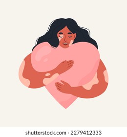 Positive woman with vitiligo embraces a heart with love. Self acceptance, self love. Concept to support people living with vitiligo.Vector flat illustration.