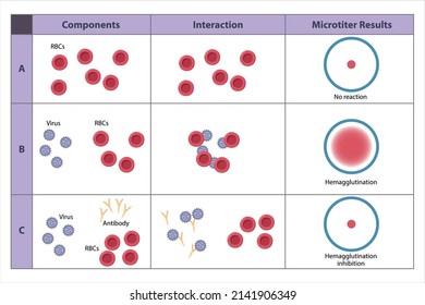 Mögliche Ergebnisse des Hämagglutinationstests. Agglutination von Erythrozyten. Die virusspezifischen Antikörper hemmen die Agglutination. Erythrozyten binden sich nicht zusammen und sinken nicht an den Boden der Bohrlochplatte 