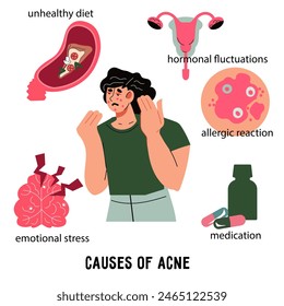 Afiche sobre las causas del acné y cómo cuidar la piel a través de la dermatología. Problema de piel causa infografía, Ilustración vectorial plana sobre fondo blanco.