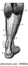 Región posterior de la pierna. B. digitórum de flexor. C. Tibialis posterior tendón. D. maléolo medial. E. Aquiles tendon, F. Tendón de Aquiles en el calcáneo. G. cuello peritoneal. H. soleus.