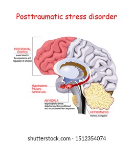 Posttraumatic stress disorder is a mental disorder. Humans brain with Regions of the brain associated with stress and PTSD.