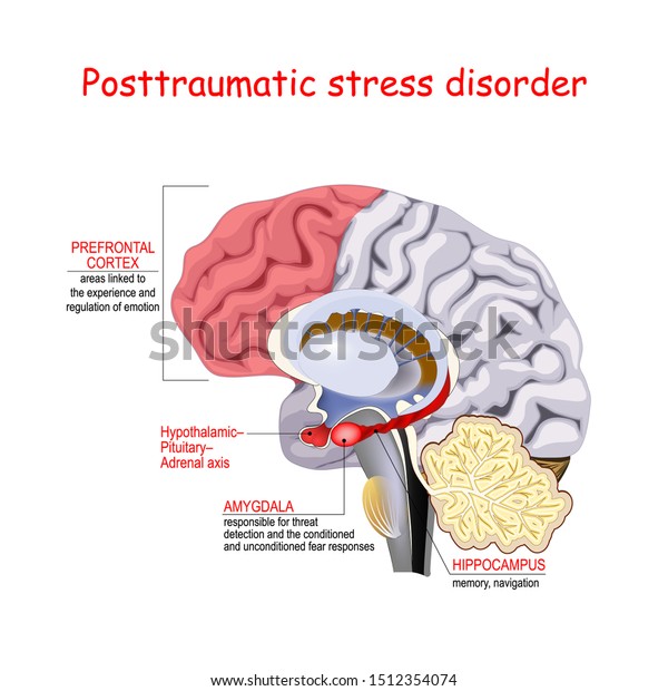 612 Ptsd Brain Images, Stock Photos & Vectors | Shutterstock