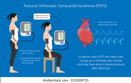 Postural Orthostatic Tachycardia Syndrome Pots Intolerance Stock Vector ...