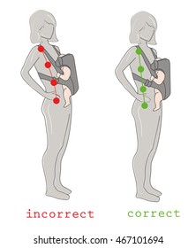 posture of a woman who has a child in a bag (sling) at breasts. correct and incorrect posture. vector illustration.