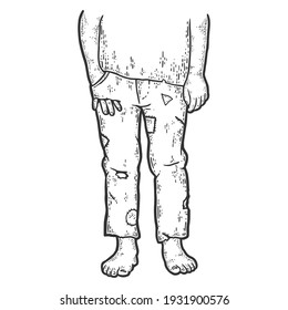 Poverty. Leaky pockets, boy hand peeking out of his pants. Sketch scratch board imitation.