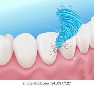 The power of washing removes dirt between the teeth. Used in advertising media for mouthwash, oral irrigators, toothbrushes. Realistic concept vector illustration file.