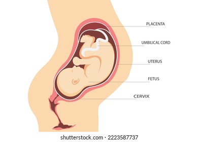 Pregnancy. Anatomy of the uterus with a fetus