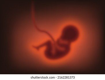 Pregnancy concept. Blurred Child in the womb, embryo. Vector illustration. Eps 10.