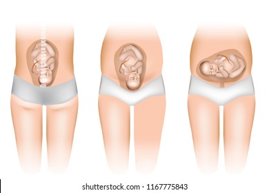 Fetus Position Images Stock Photos Vectors Shutterstock