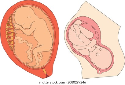 Pregnancy - Different Positions of Baby in the Womb. Fetus Positions In Uterus