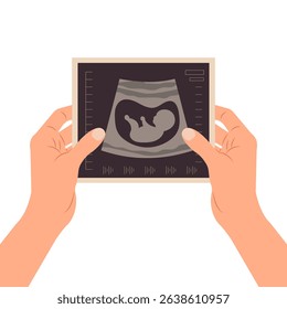Pregnancy screening. Ultrasound of the baby. Female hands holding a photo of a baby on ultrasound scan in the womb.
