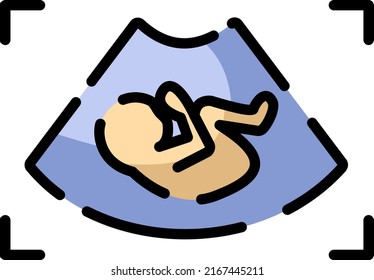 Pregnancy ultrasound, illustration, vector on a white background.