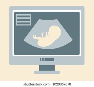 Pregnancy ultrasound scan isometric design vector illustration. Embryo on the ultrasound scanner screen.