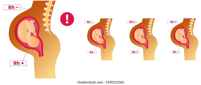 Rhesus Factor Hd Stock Images Shutterstock