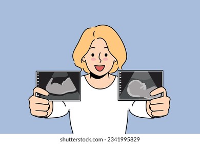 Pregnant woman boasts of ultrasound images of baby in womb of future mother in prenatal period. Pregnant blonde girl smiles and prepares to become mom and give birth to healthy newborn