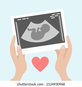 A pregnant woman holds a picture of an ultrasound examination of the fetus in her hands. ultrasound image of an unborn child. examination of a human fetus inside the uterus during pregnancy. 