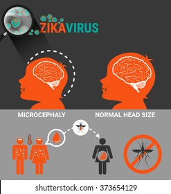 Pregnant Women with baby microcephaly and Zika Virus Infection