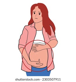 Pregnant women with stretch marks on the stomach.