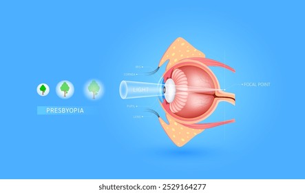 Presbicia y visión borrosa. Punto focal detrás de la retina. Los objetos distantes se verán más claramente que los que están cerca. Anatomía del sistema visual humano. Diagnóstico de ciencia médica. Vector EPS10.