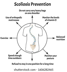 Prevention of Scoliosis. Spinal curvature, kyphosis, lordosis of the neck, scoliosis, arthrosis. Improper posture and stoop. Infographics. Vector illustration on isolated background.