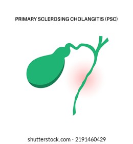 Primary Sclerosing Cholangitis Concept. PSC Gallbladder Disease.Abdomen Pain In The Human Body. Inflammation In The Digestive System. Internal Organ Examination In Clinic. Medical Vector