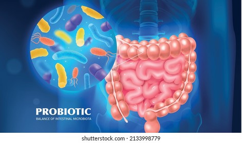 Probiotic as tool for balance of intestinal microbiota advertising background realistic vector illustration