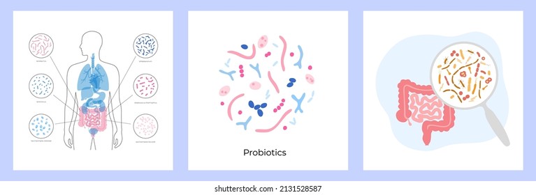 Probiotics and gastrointestinal health concept. Most common beneficial good bacteria and microorganisms. Healthy food, human gut microbiota. Set of medical infographics vector isolated illustration.