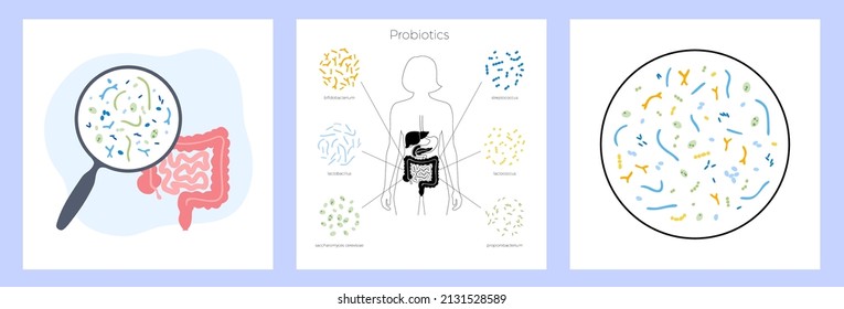 Probiotics And Gastrointestinal Health Concept. Most Common Beneficial Good Bacteria And Microorganisms. Healthy Food, Human Gut Microbiota. Set Of Medical Infographics Vector Isolated Illustration.