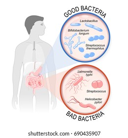 Probiotics. gut flora: Good (Lactobacillus, Bifidobacterium longum, Streptococcus thermophilus) and Bad (Streptococcus, Salmonella typhi, Helicobacter pylori) bacteria. 