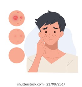 problem skin concept.man with pimples on his face,facial skin troubled. flat vector cartoon character illustration.