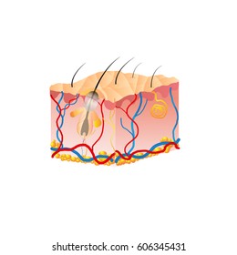 The problem skin pores clogged causing acne.vector illustration design.