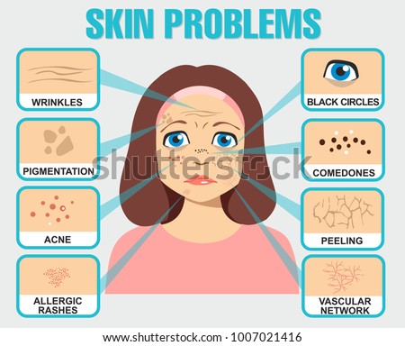 Agree, your skin condition scaly facial skin Skin condition scaly facial skin fill
