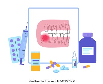 Problems with human jaw and wisdom tooth. Dentistry, dental care concept. Teeth anatomy poster flat vector illustration. Oral hygiene banner. Medicine, pills, diagnostics, treatment of dental diseases