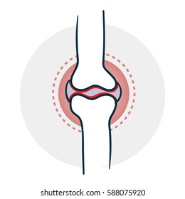 Problems with joints. Drugs Icon on medical subjects. Illustration of a funny cartoon style