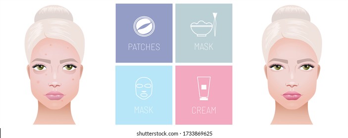 Problems on the skin pimples and acne, and dark circles under the eyes, and treatment options. Types of cosmetics masks, patches under the eyes and cream. Express skin treatment.