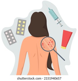 Problems with the skin of the back. Girl with a bare back with acne. Dermatologist appointment. Medicines for dermatitis, ointment for acne and fungus.