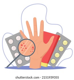 Problemas con la piel de las palmas. Dermatólogo, medicamentos para alergias, eczema o dermatosis. Palm con inflamación sobre un fondo blanco.