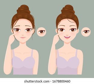 Problemas de arrugas y ojos negros